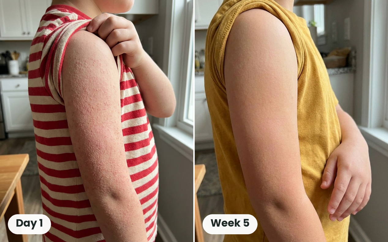 Soft, Smooth Arms Again in 4 to 12 Weeks: The Gentle Cream That Fixes Both Halves of Bumpy Skin 32 Customer before and after, Day 1 and Week 5