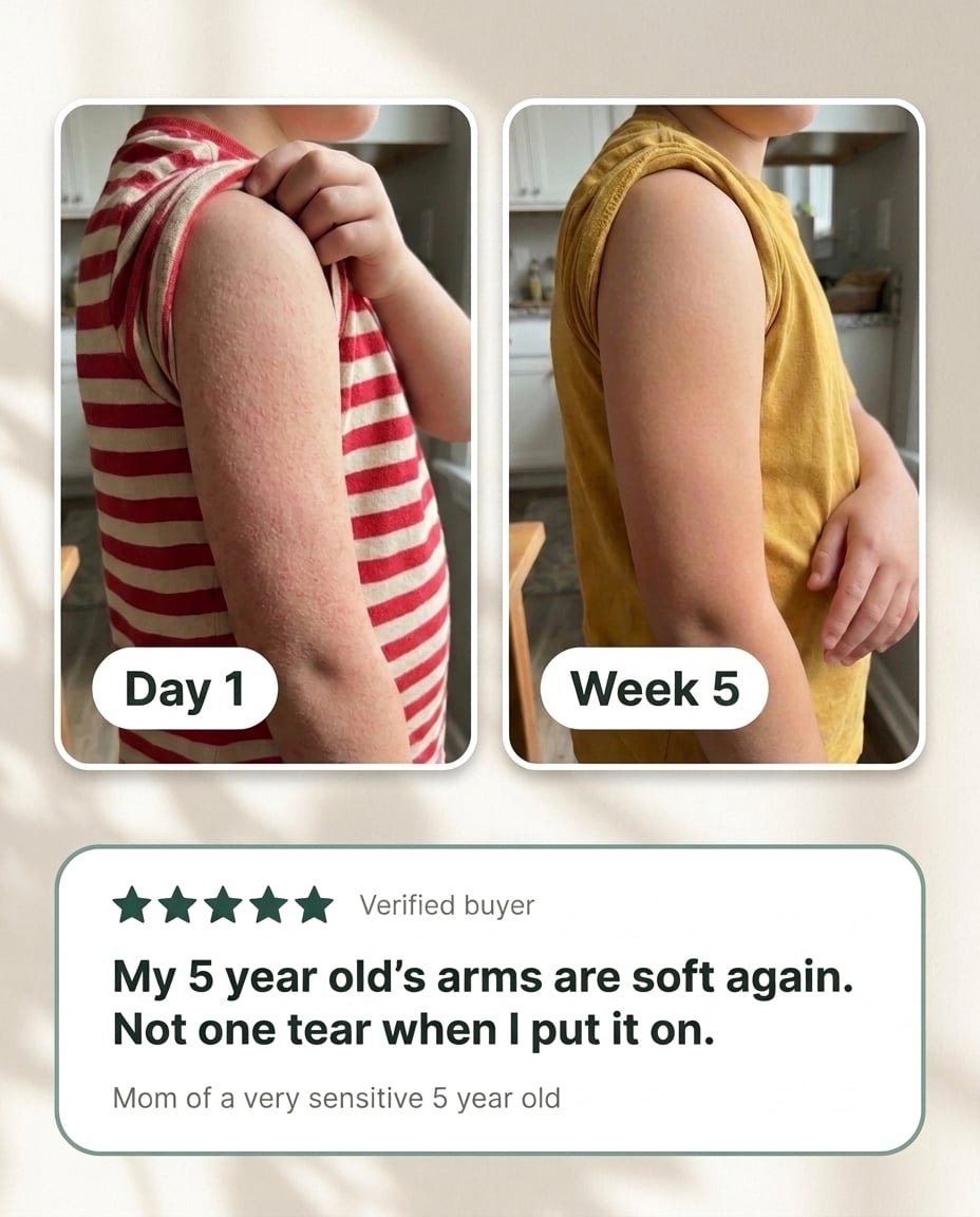 Soft, Smooth Arms Again in 4 to 12 Weeks: The Gentle Cream That Fixes Both Halves of Bumpy Skin 2 Customer before and after photos. Time shown: 3 to 7 weeks