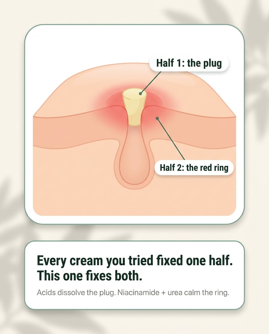 Soft, Smooth Arms Again in 4 to 12 Weeks: The Gentle Cream That Fixes Both Halves of Bumpy Skin 4 Diagram of a pore with a plug labelled Half 1 and a red ring labelled Half 2